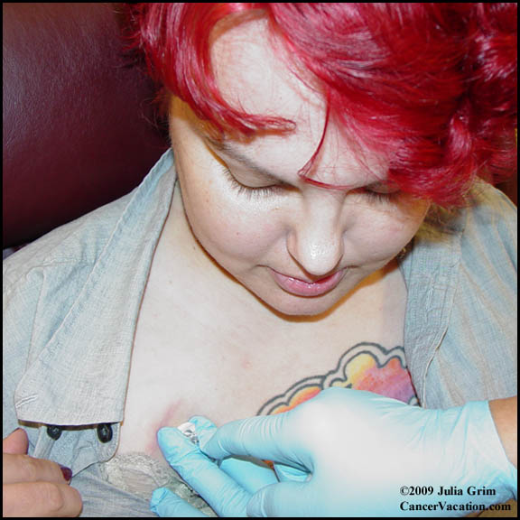 Internal chemo view...