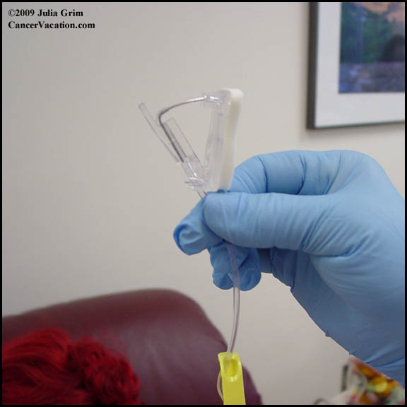 Internal chemo view...