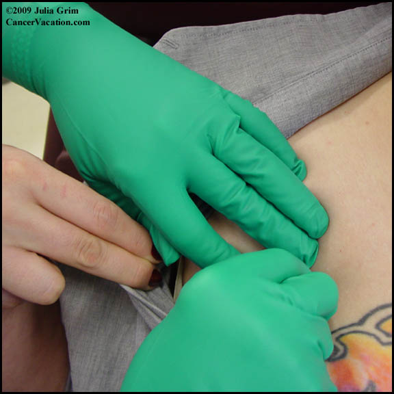 During my chemo...