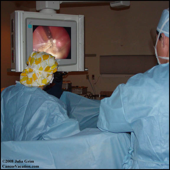 Internal view during my hysterectomy...