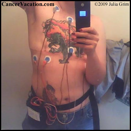 48 hour holtor monitor to watch for irregular heartbeats...
