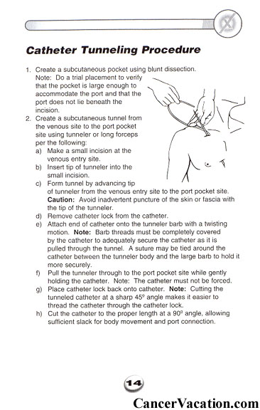 Excerpts from an implanted port manual...